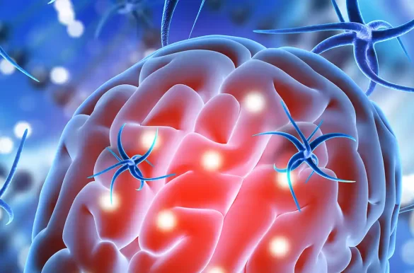 Serebrovasküler Hastalıklar